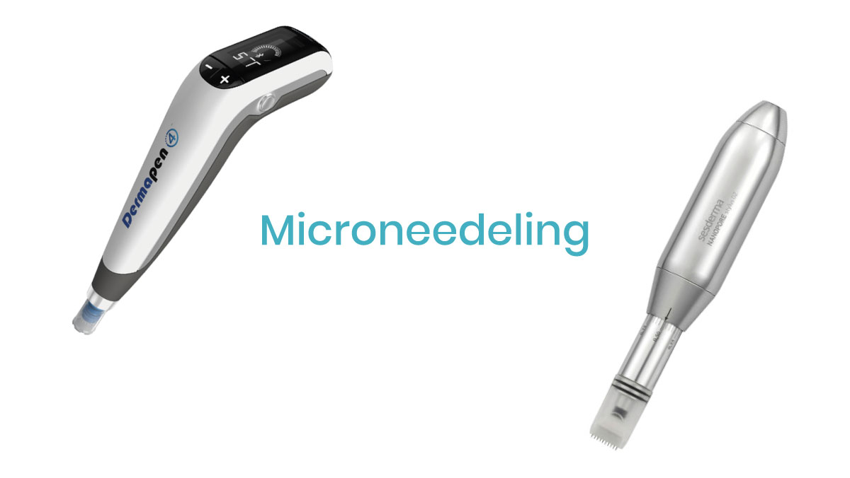 microneedeling