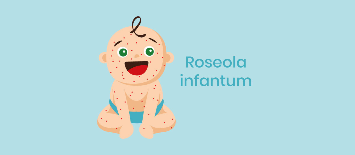 Roseola infantum